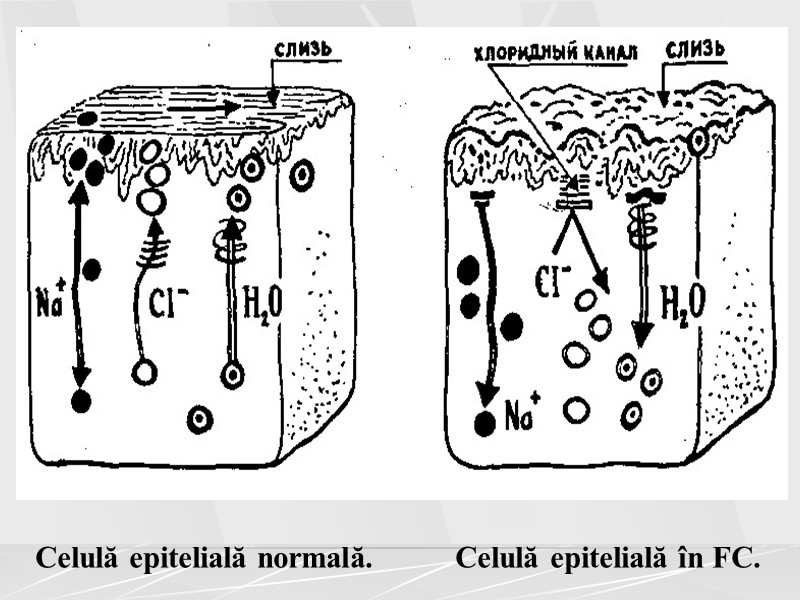 Celulă epitelială normală.          Celulă epitelială